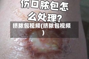 挤脓包视频(挤脓包视频)