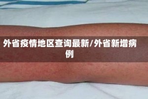 外省疫情地区查询最新/外省新增病例