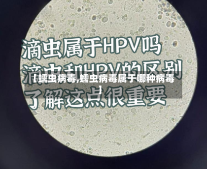 【蠕虫病毒,蠕虫病毒属于哪种病毒】