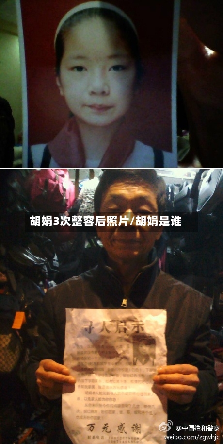 胡娟3次整容后照片/胡娟是谁-第3张图片