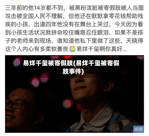 易烊千玺被寄假肢(易烊千玺被寄假肢事件)-第1张图片