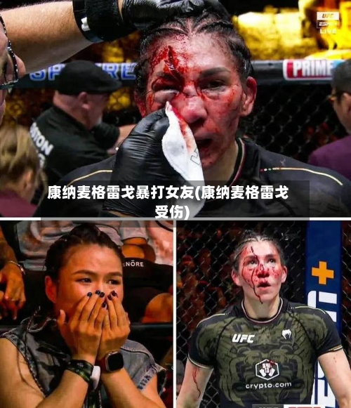 康纳麦格雷戈暴打女友(康纳麦格雷戈受伤)-第1张图片