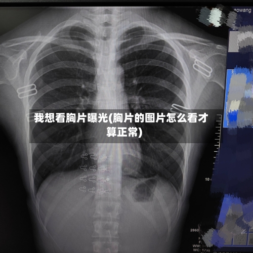 我想看胸片曝光(胸片的图片怎么看才算正常)-第3张图片