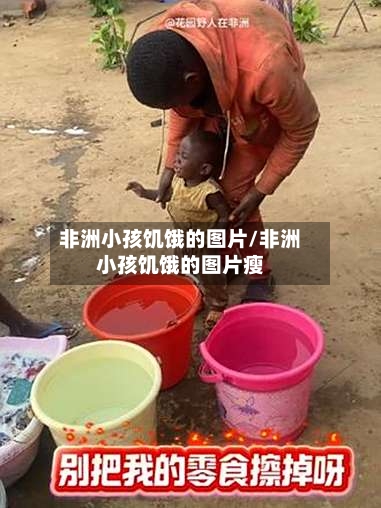 非洲小孩饥饿的图片/非洲小孩饥饿的图片瘦-第1张图片